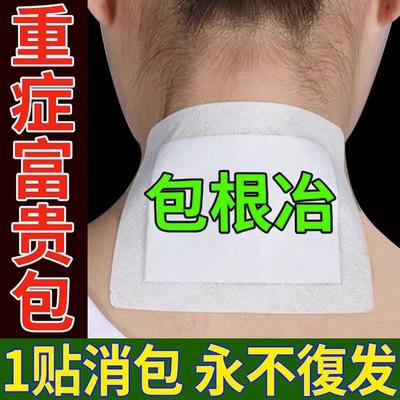 去除富贵消除包贴正品神器矫正颈椎特效快速疏通肩颈部专用药膏贴