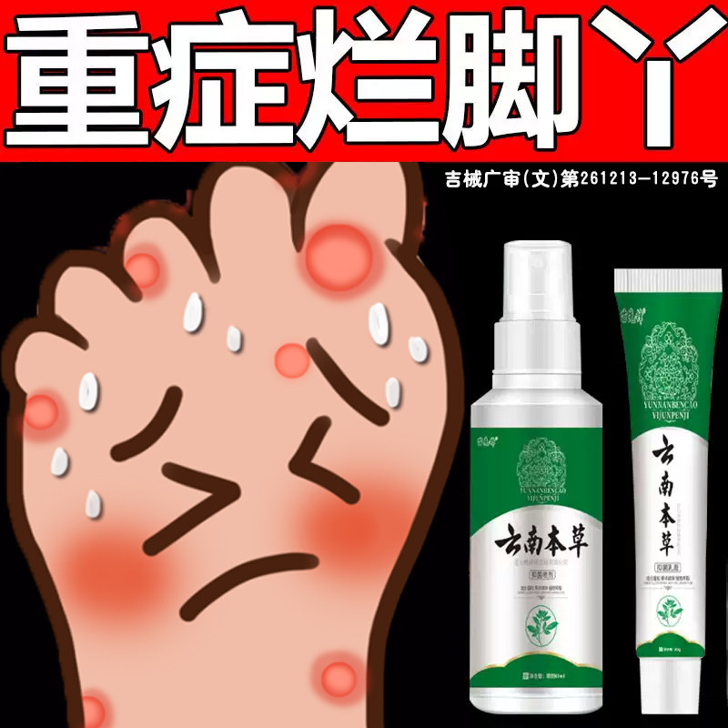 云南本草脚气喷剂烂脚丫糜烂去脚气止痒脱皮杀菌真菌感染专用神xl