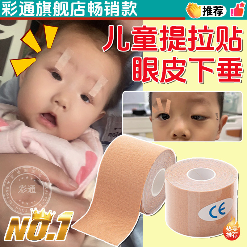 【眼皮下垂提拉贴】眼皮无力下垂