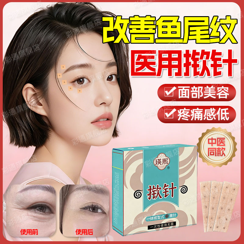 【改善鱼尾纹】医用揿针穴位贴