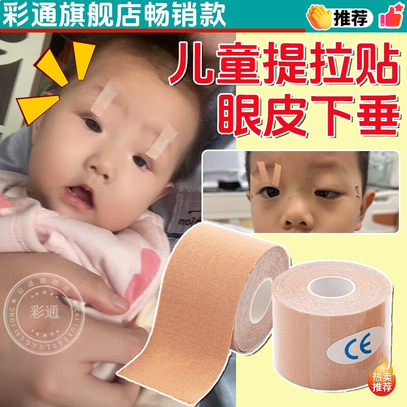 【眼皮下垂提拉贴】眼皮无力下垂