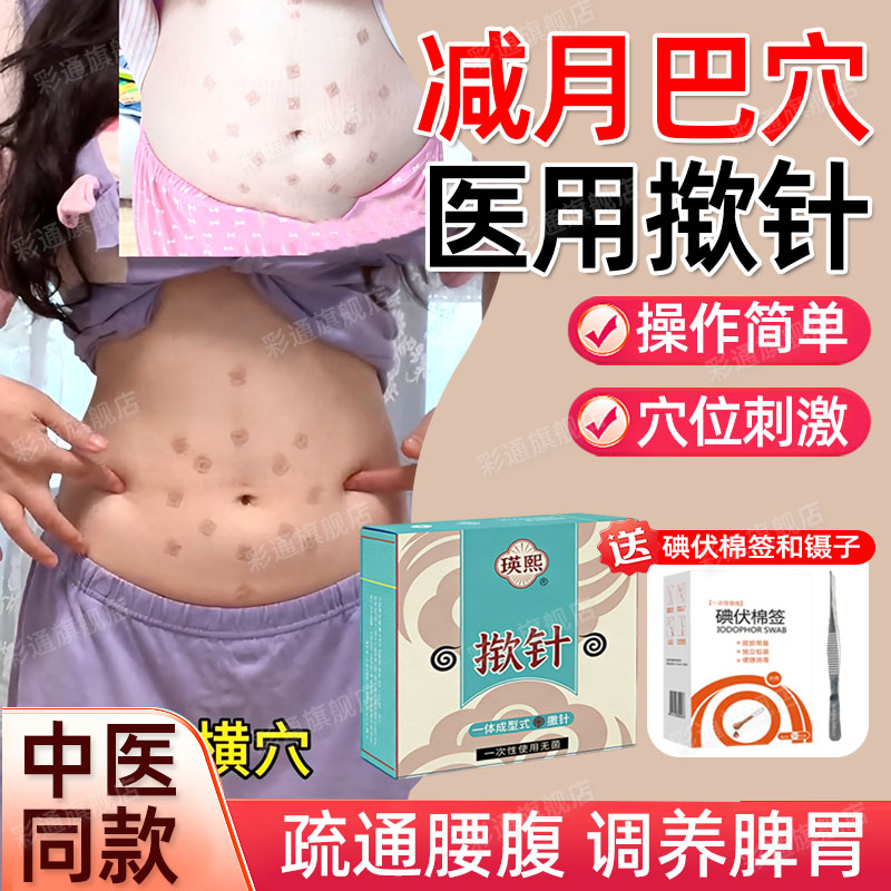 【肚子肥大专用】揿针穴位贴医院
