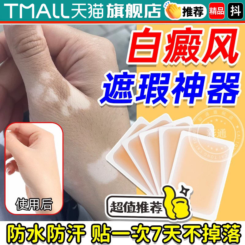 【持久遮瑕】白癜风遮瑕神器夏季