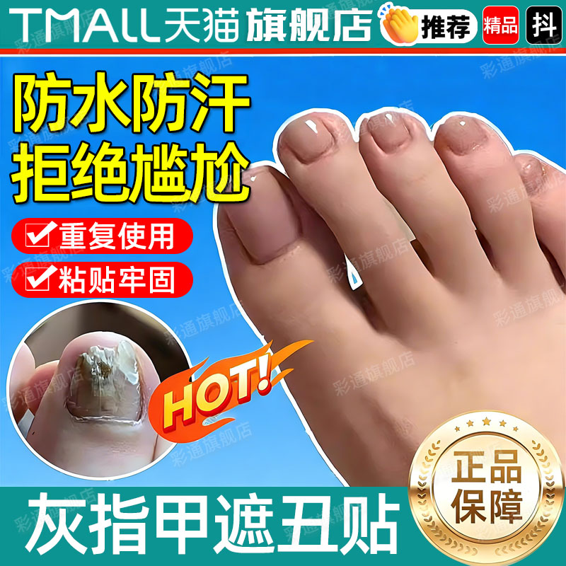 灰指甲贴片夏季凉鞋专用脚趾甲