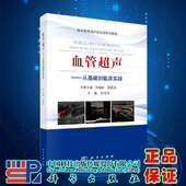 现货血管超声从基础到临床实践科学出版 社