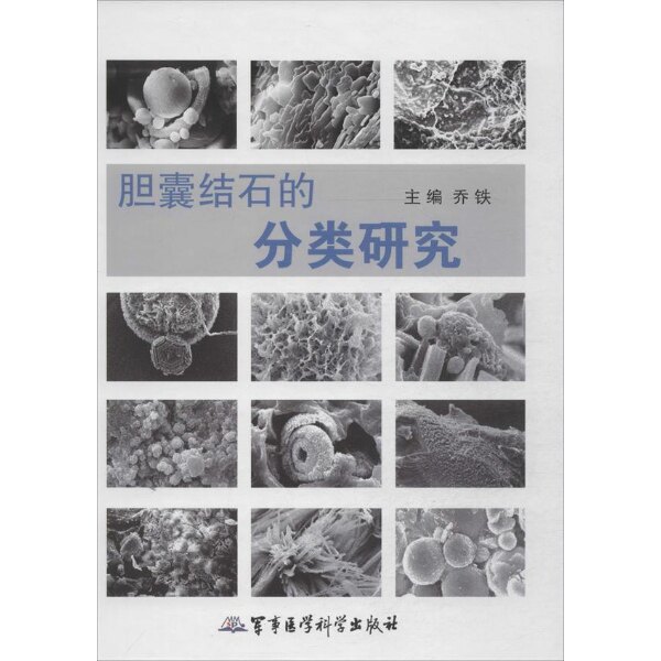 胆囊结石的分类研究
