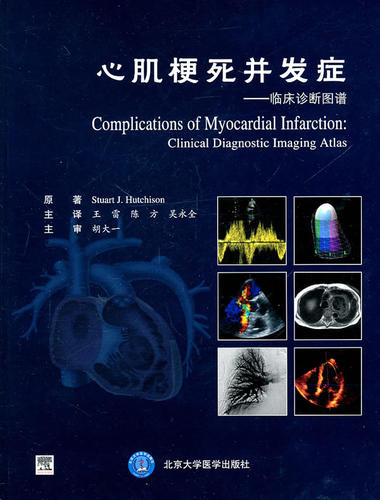 心肌梗死并发症--临床诊断图谱(精)