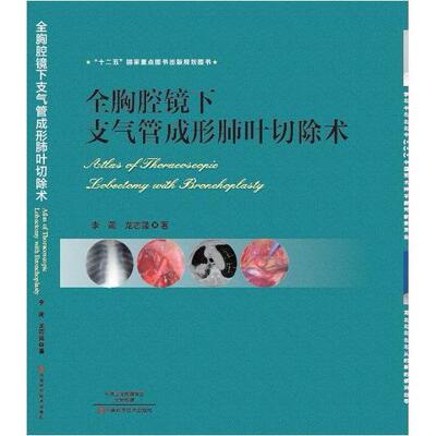 全胸腔镜下支气管成形肺叶切除术