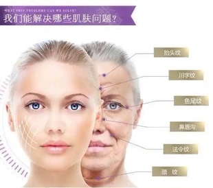 【院线】4.0刷 酶提拉面膜