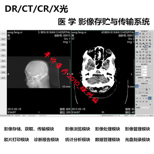 Ｃ型臂正版 X光 加密狗图文报告 MRI 数字DICOM工作站软件DR