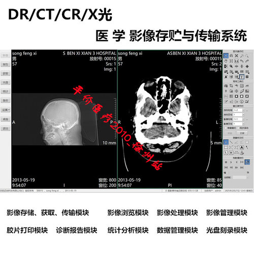 正版加密锁DICOM工作站软件