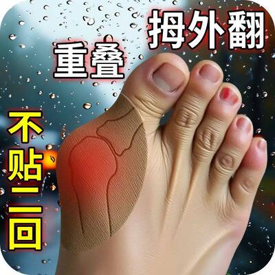拇外翻贴脚趾重叠外翻专用膏贴