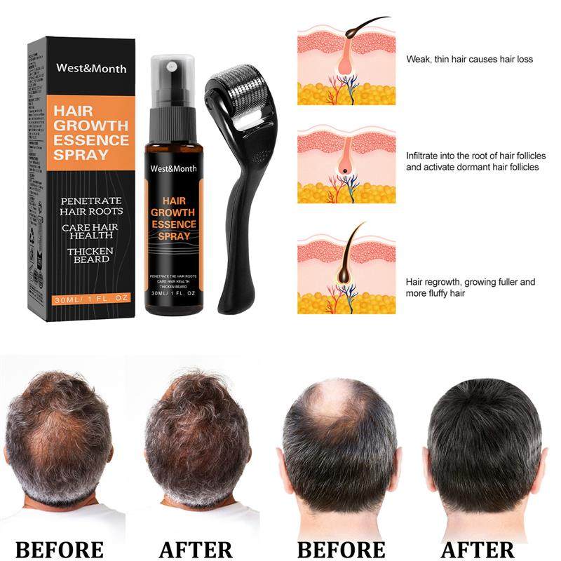 & Discontinuing hair and nursing fluids with a dense hair sp