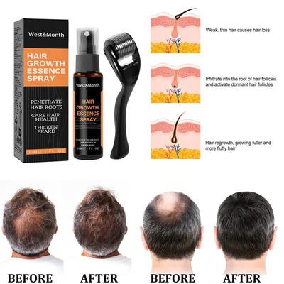 & Discontinuing hair and nursing fluids with a dense hair sp