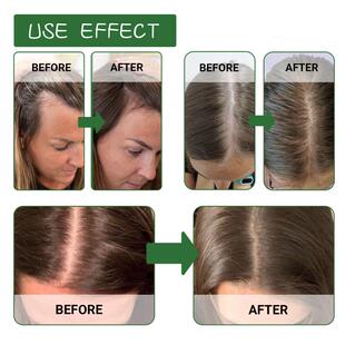 Batanas hair oils, hair repairs, elastic fixation of hairs,