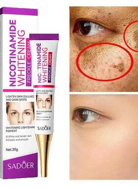 Freckle Removing Cream Repair Pigmentation Nicotinamide Whit