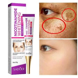 Freckle Removing Cream Repair Pigmentation Nicotinamide Whit