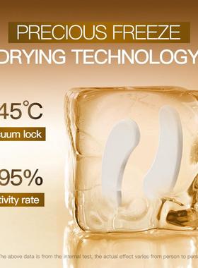 The osteoportic urinary acid is so tight that the frozen dry