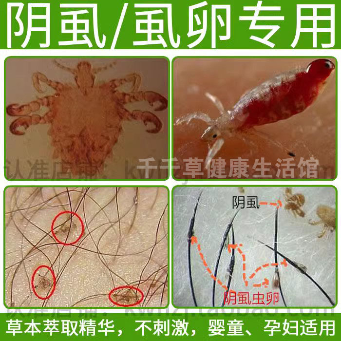阴虱喷雾剂男女私处用百部酊成人虱子阴虱专用药虫卵双杀虱卵阴毛