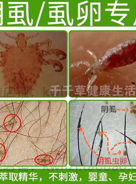 阴虱喷雾剂男女私处用百部酊成人虱子阴虱专用药虫卵双杀虱卵阴毛