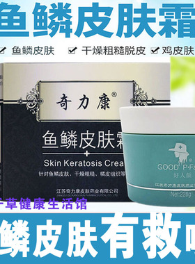 奇力康鱼鳞皮肤霜228克 针对鱼鳞皮肤干燥粗糙脱皮鸡皮肤橘皮组织