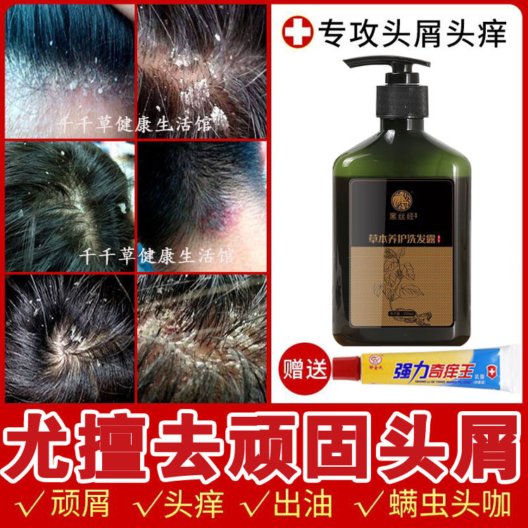 去顽固头屑头痒洗发水念头痒肤消屑宵迪头屑立屑立停头藓立净