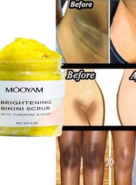 Turmeric Kojic Acid Body Scrub Strong Whitening Bikini Area