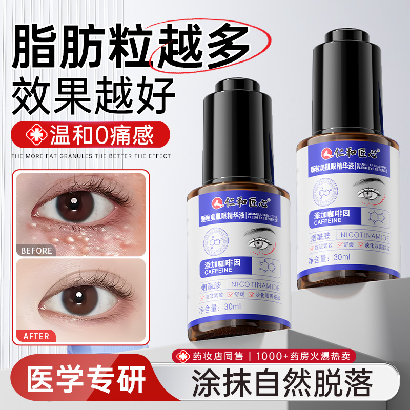 仁和脂肪粒颗粒清肌眼部油脂粒眼角眼周眼霜精华液祛汗管去除神器
