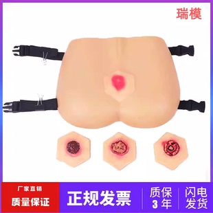 阶段褥疮护理模型 褥疮压疮培训教具 臀部褥疮模型医学教学用模型