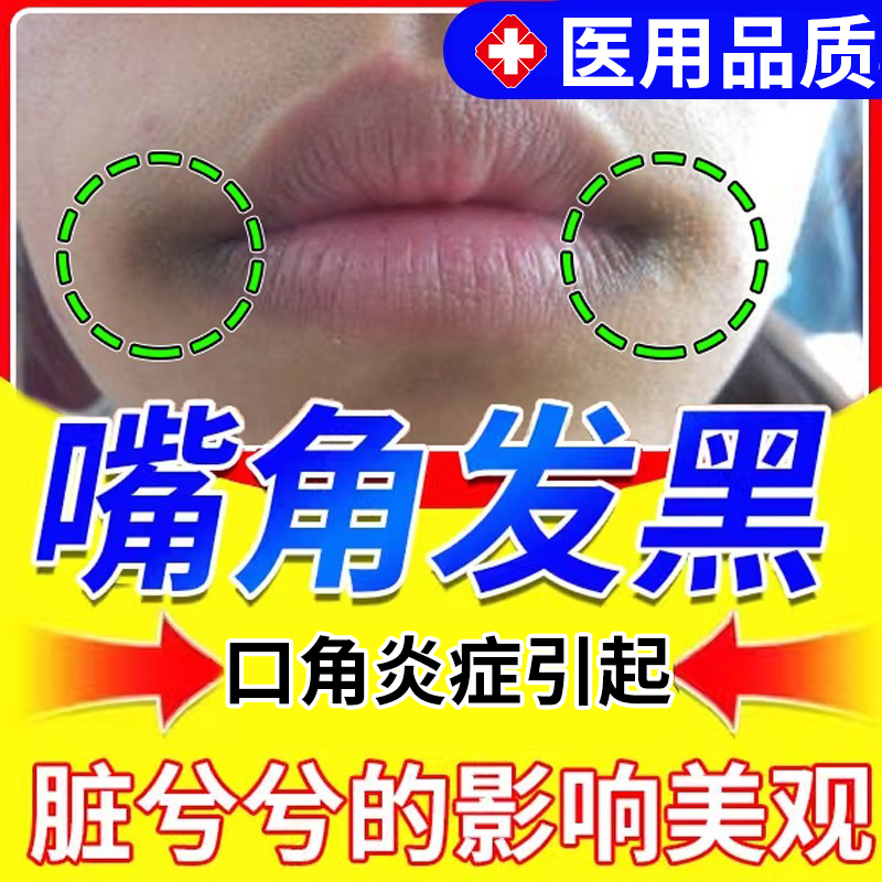 嘴角发黑黑色素沉淀去除嘴巴周边黑唇周黑嘴角暗沉唇炎色素沉着PG