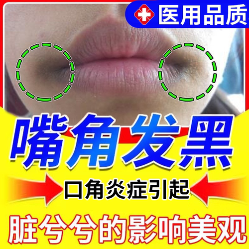 【药监备案】嘴角唇周发黑暗沉