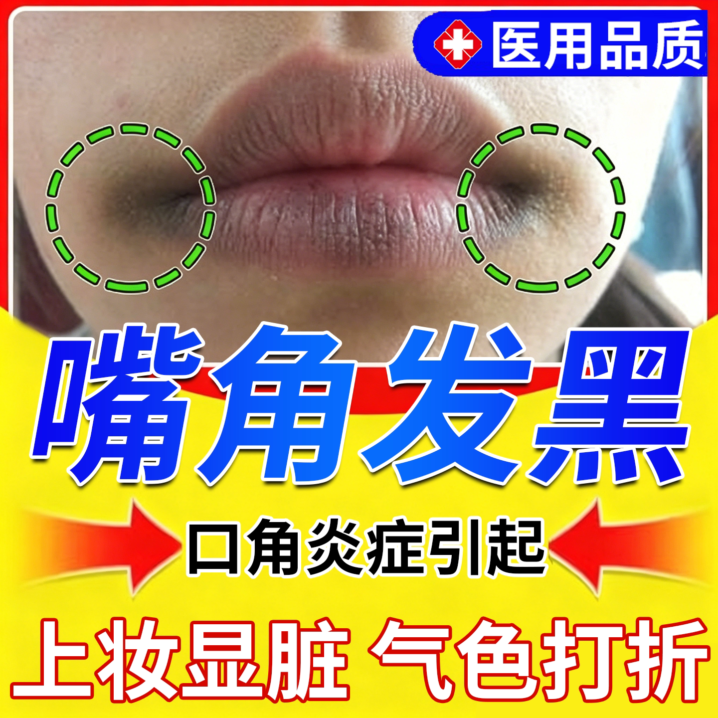 【药监备案】嘴角唇周发黑暗沉
