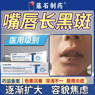 嘴唇长黑斑药监备案色素沉积去除唇周炎症黑点黑痣膏唇部PG