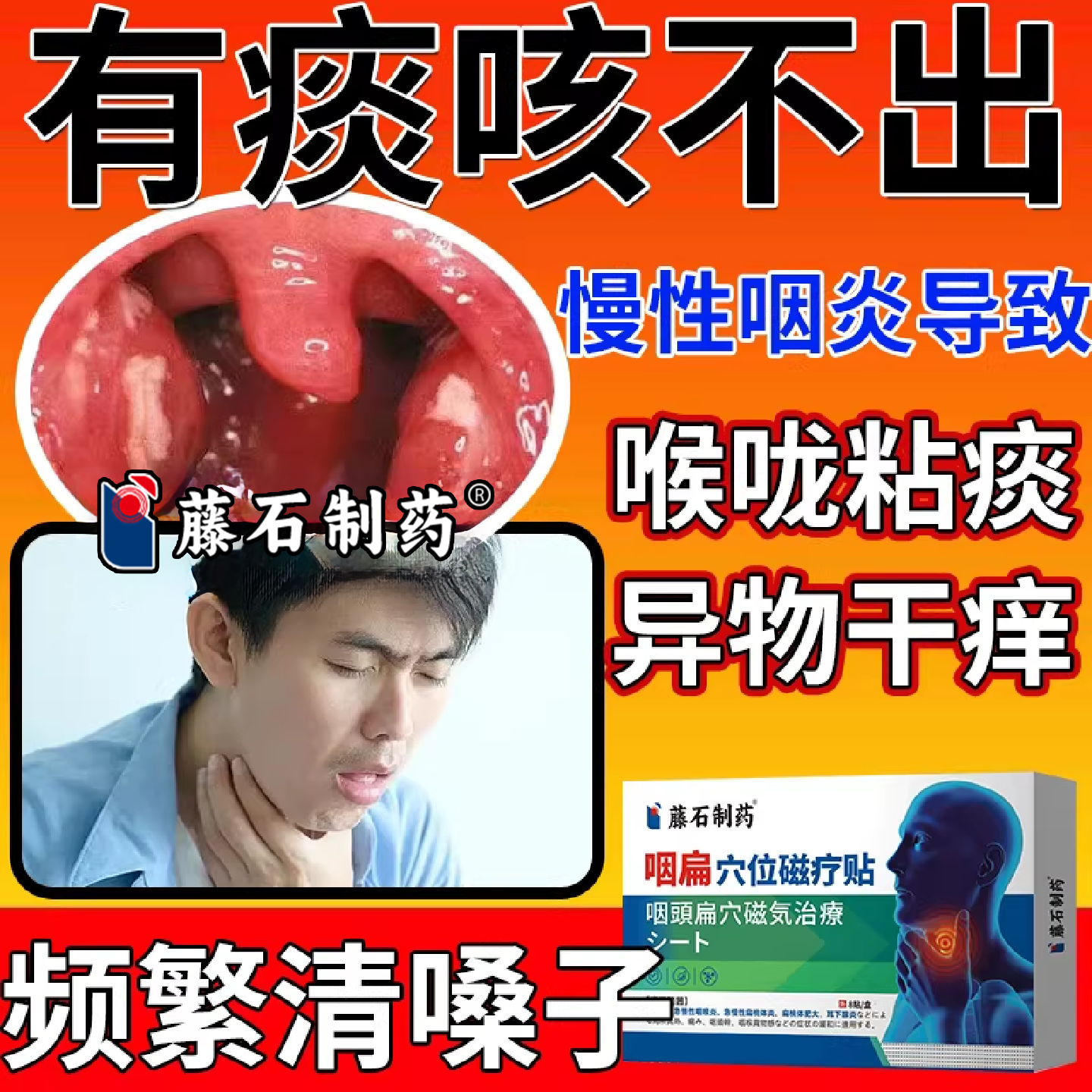 有痰咳不出咽喉淋巴滤泡增生咽炎干痒咳嗽异物感贴药监备案PG