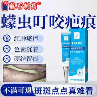 蠓虫叮咬疤痕蚊虫叮咬黑印疤痕凝胶去黑色素沉淀医用祛疤膏PG