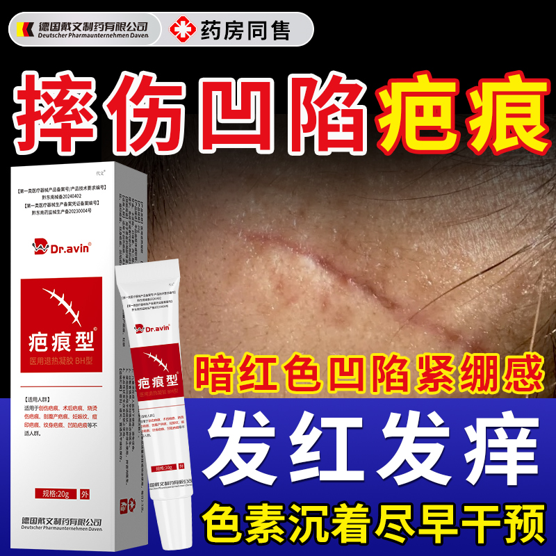 摔伤凹陷疤痕祛疤膏淡化红印色素沉着增生代文祛疤凝胶药房同售N6