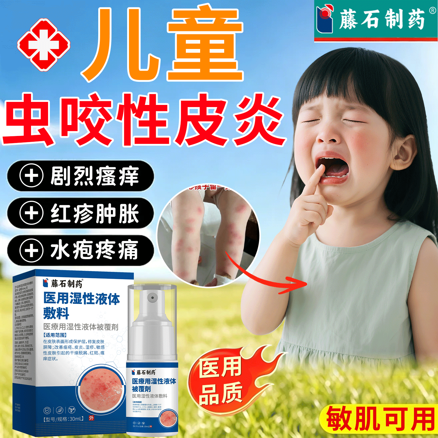 儿童虫咬性皮炎专用蚊螨虫叮咬抗敏止痒膏丘疹性荨麻疹喷雾N6