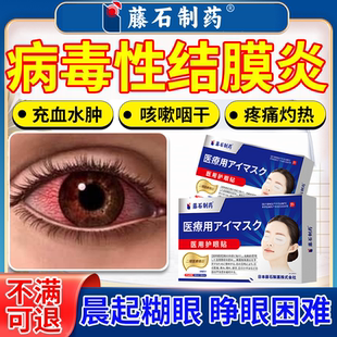 病毒性结膜炎医用护眼贴药监备案结膜充血畏光流泪眼部疼痛用PG