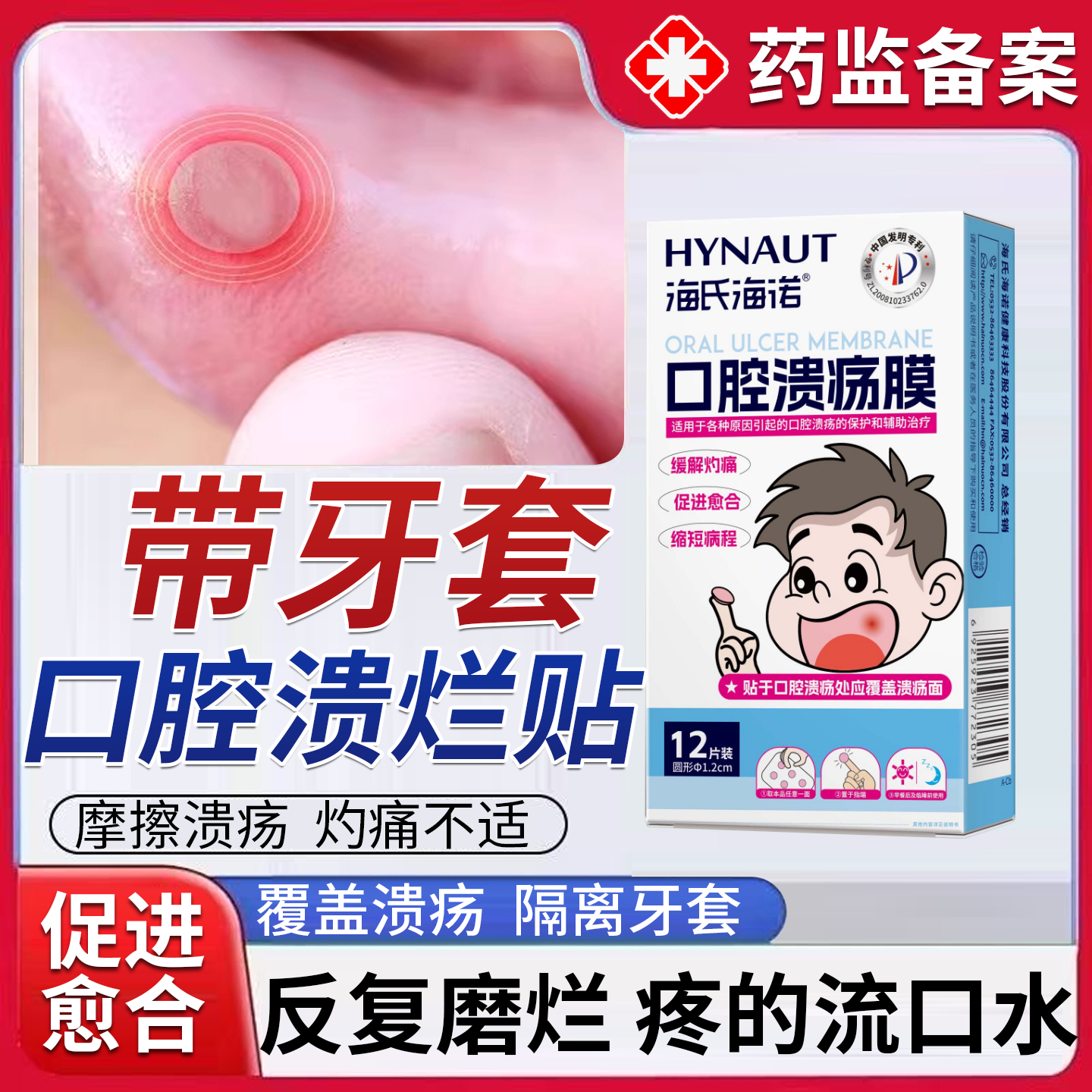 带牙套正畸口腔溃疡贴片膜整牙磨嘴防磨隔离儿童舌头起泡专用PG