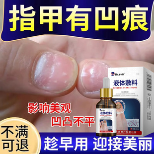 指甲凹凸不平液真菌感染有竖纹儿童甲萎缩受损凹陷变形坑洼PG