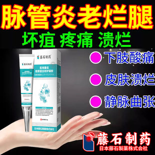 脉管炎特老烂腿专用小腿静脉曲张发黑紫血栓管炎烂足伤口愈合CA