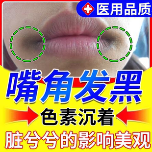 嘴角黑色素沉淀去嘴角两边发黑嘴唇唇炎除药房同售喷雾剂PG
