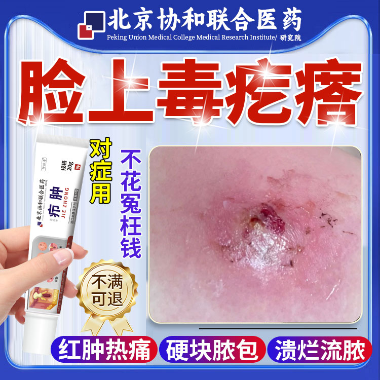 脸上毒疙瘩疖肿火疖子硬块拔毒拔脓皮脂腺囊肿可搭配膏药贴na