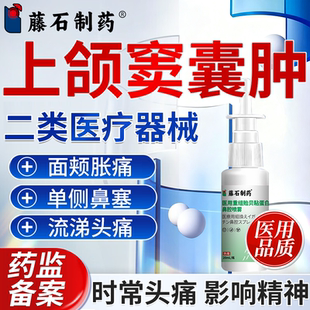 上颌窦炎囊肿鼻窦炎鼻塞头痛胀痛流鼻涕打喷嚏喷雾剂药监备案PG