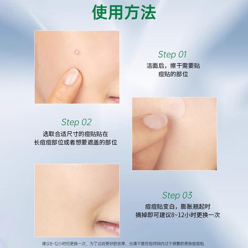 痘痘贴品去痘医淡ASS化痘印肌正修覆暗疮痕净吸脓炎非消隐形用豆