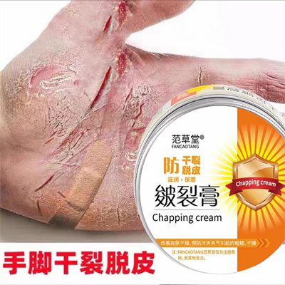 手指头裂口子开裂脱皮防裂蛇油干裂护手霜手足开口手脚皲裂膏