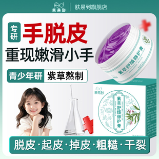 青少年手脱皮膏维生素小孩手足手指倒刺护手霜季节性蜕皮掉皮起皮