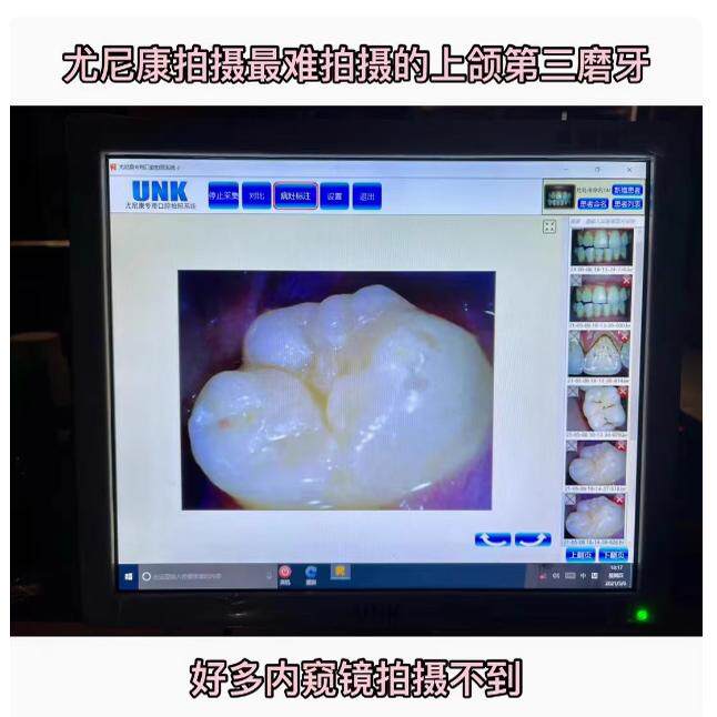 牙科优尼康UNK和茂口腔采集系统尤尼康内窥镜一体机显示器触摸屏