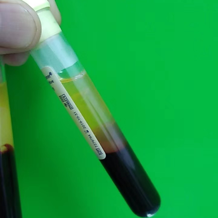 美国BD  货号 364816 ACD溶液B 6毫升  13*100mm 黄色传统头盖