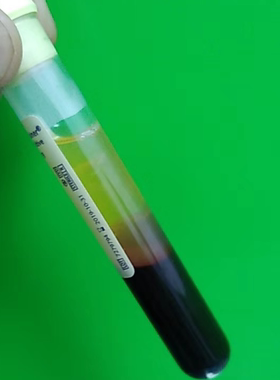 美国BD  货号 364816 ACD溶液B 6毫升  13*100mm 黄色传统头盖